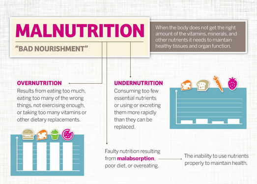 Malnutrition infographic