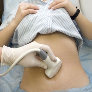 Ovarian Cancer ultrasound